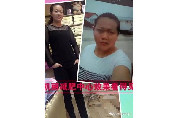 凯丽电脑减肥