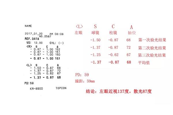 电脑验光结果