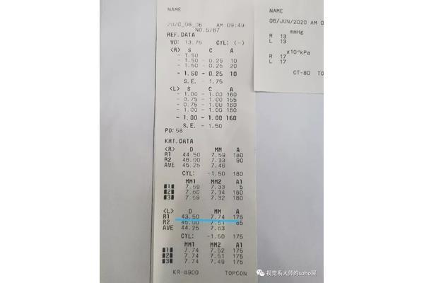 电脑验光结果