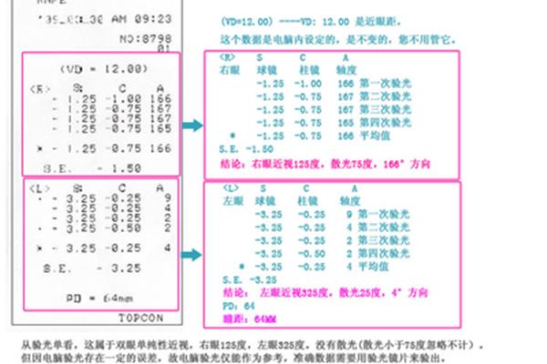 电脑验光结果