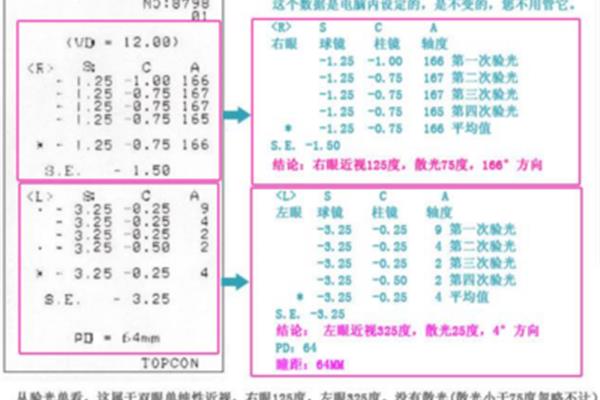 电脑验光结果